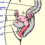 endometrioz.jpg